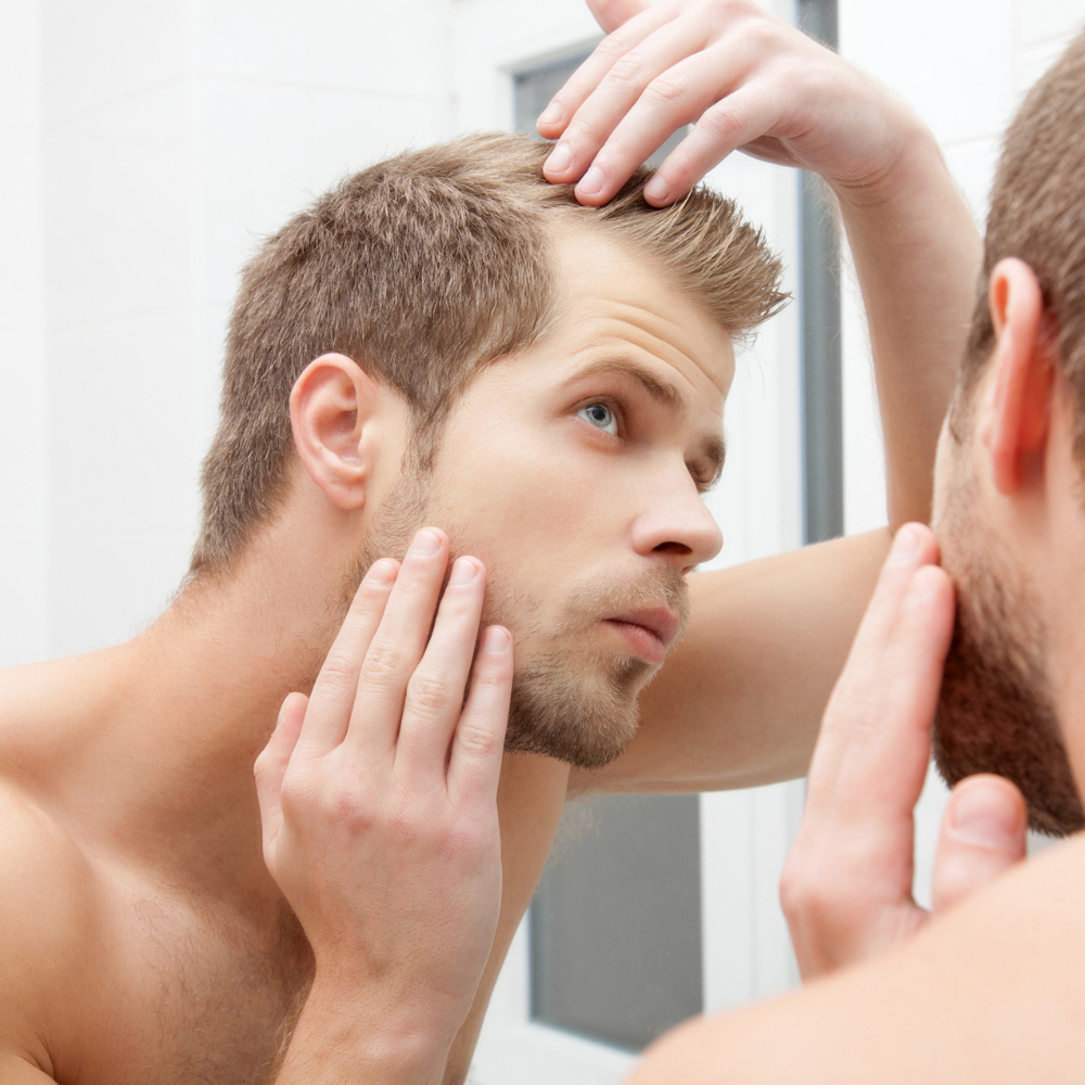 Worried About Going Bald? Here Are Our Best Tips for Fighting the Norwood Reaper